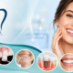 Smile Design in Gurugram